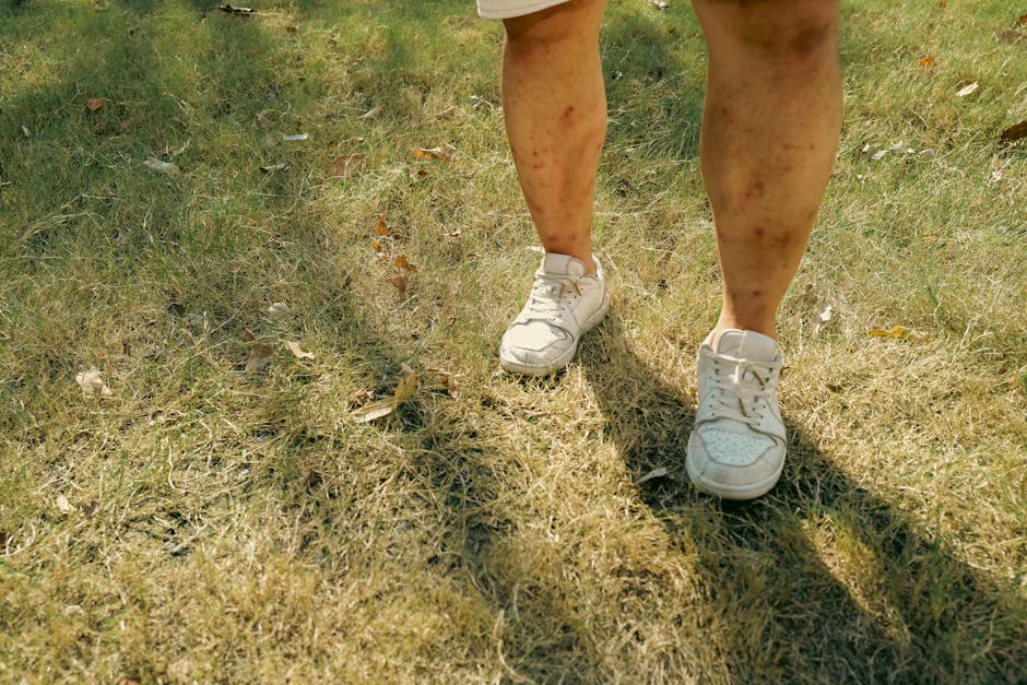 Gambe di un insegnante segnate da punture d'insetto durante la lotta per un territorio più sano e protetto.