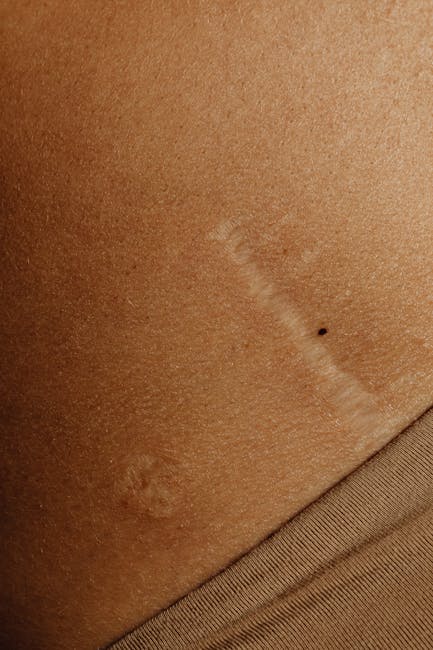 Cicatrici e ICD 10: importanza della classificazione per la gestione delle condizioni mediche e la codifica accurata nel settore sanitario.