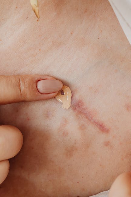 Applicazione di gel conduttivo su cicatrice per elettroterapia: fondamenti e applicazioni della corrente elettrica
