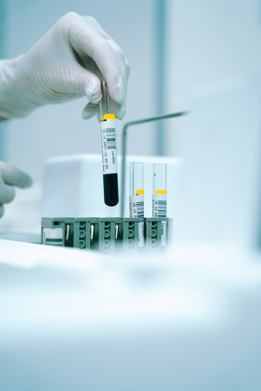 Mano guantata che tiene provetta con campione biologico, in laboratorio, per analisi dati Assegno Unico 2026